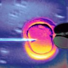 IVF - הפריה חוץ גופית. מילון מושגים