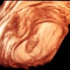 השתלה, מעקב וטכנולוגיות מתקדמות ב-IVF